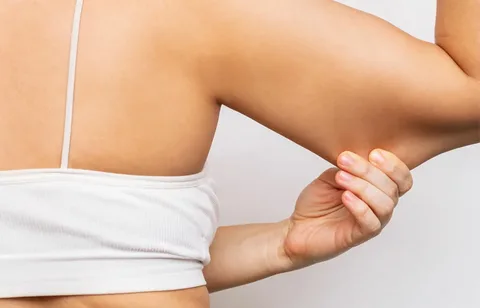 Best Cellulite Treatment in Spring, TX: Your Guide to Smoother Skin